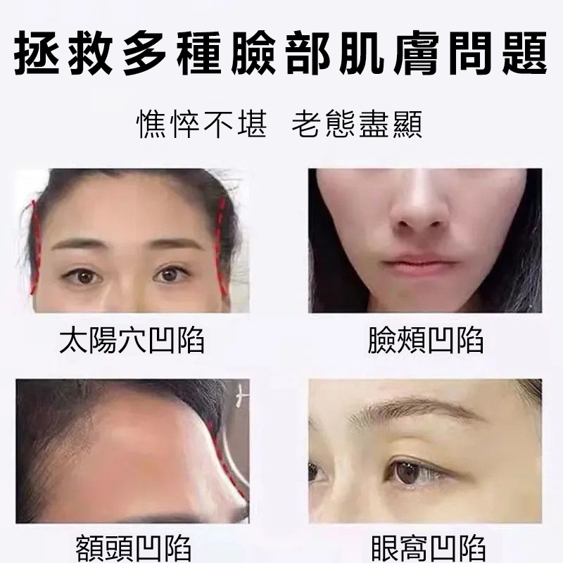 【明星力荐】【不滿意包退】魚子醬膠原蛋白填充霜法國小分子純鱘光感抗皺面霜，越用肌膚越好！裸妝自然水潤美膚！買一送一！