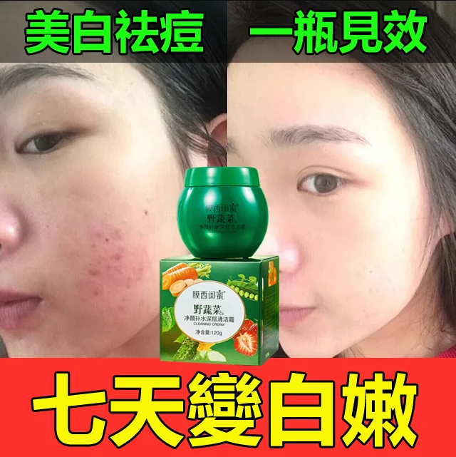 膜西野蔬菜深層補水清潔霜,清除黑頭,趕走痘痘,可以養膚的清潔霜,深層清潔,肌膚水嫩嘭彈 膜西野蔬菜深層補水清潔霜,清除黑頭,趕走痘痘,可以養膚的清潔霜,深層清潔,肌膚水嫩嘭彈